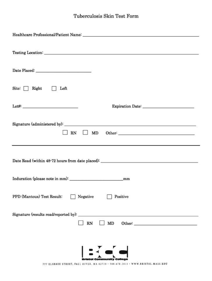 Tb Skin Test Read Form 2020 Fill And Sign Printable Template Online